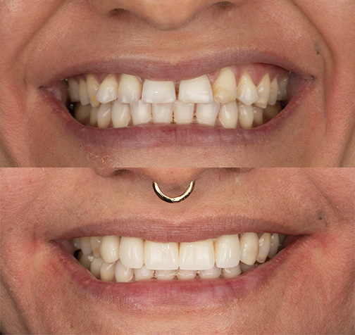 Case #9: Danny Merged Image