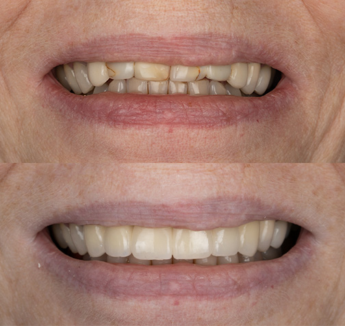 Case #2: Nancy Merged Image