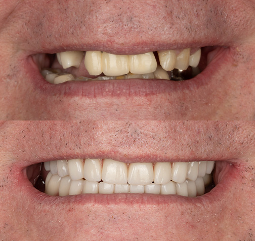 Case Study #7: Milak Merged Image