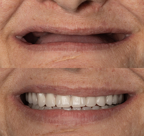 Case Study #4: Lucy Marge Image