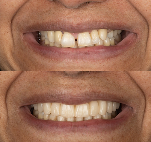 Case Study #6: Maria Merged Image