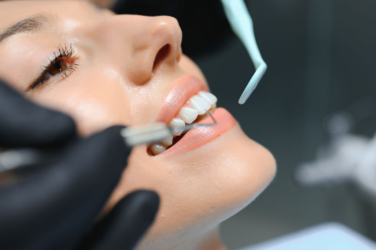 How Cosmetic Dentistry Can Improve More Than Just Your Smile Image